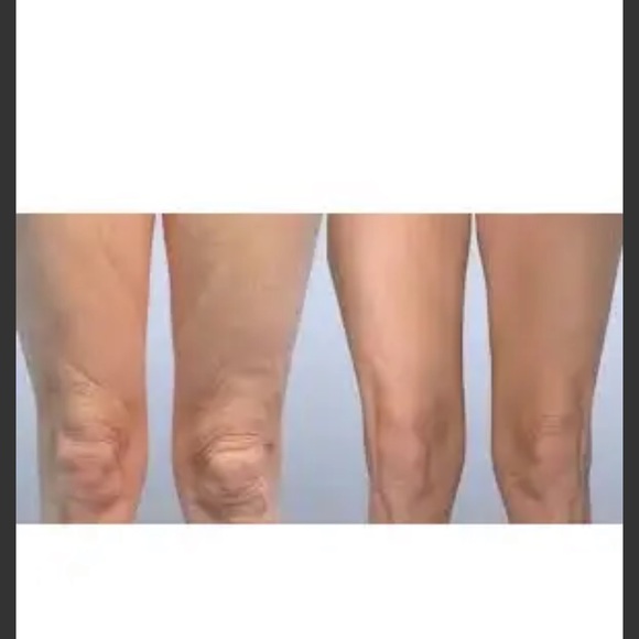 Kami Pure Anti Wrinkle Knee Pad - Botox Alternative 30 uses NEW - Picture 2 of 2